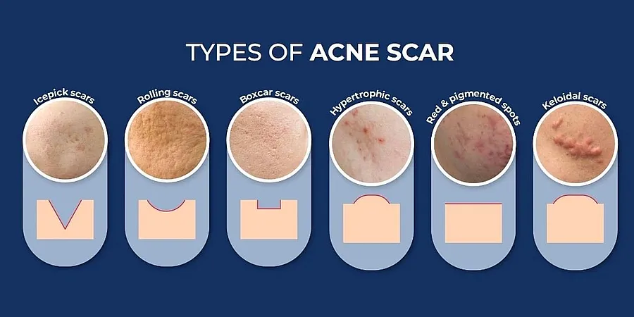 therapy-oulon θεραπεία ούλων